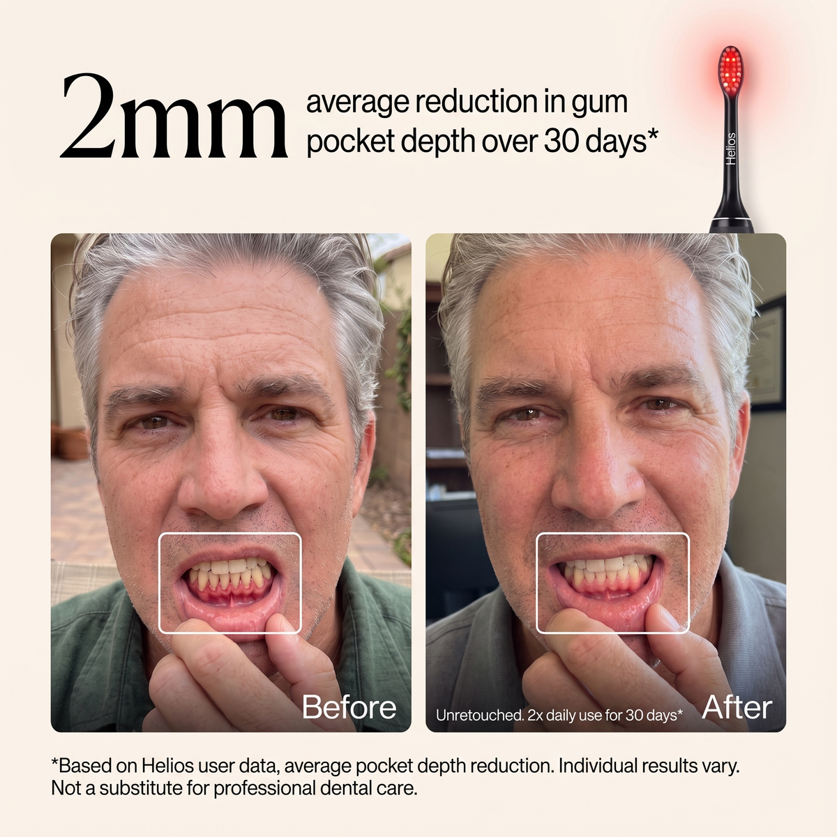 Helios Gum Recovery Pro Toothbrush