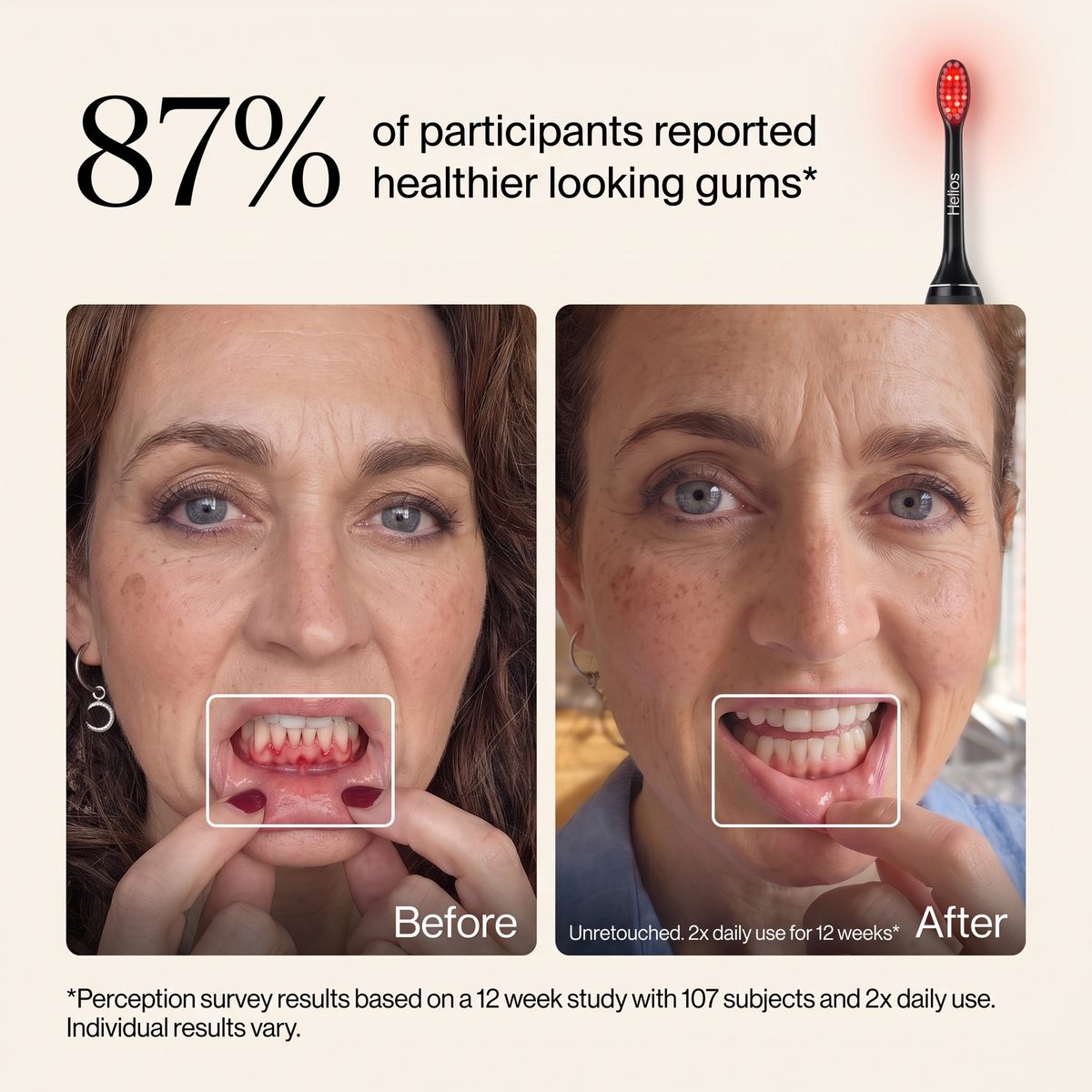 Helios 3-in-1 Therapy Toothbrush