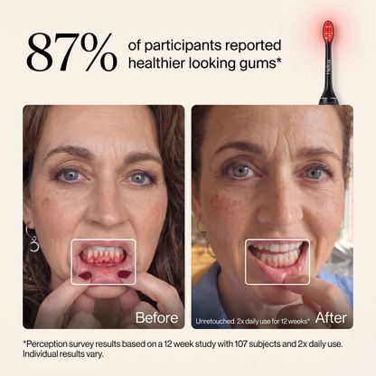 Helios 3-in-1 Therapy Toothbrush