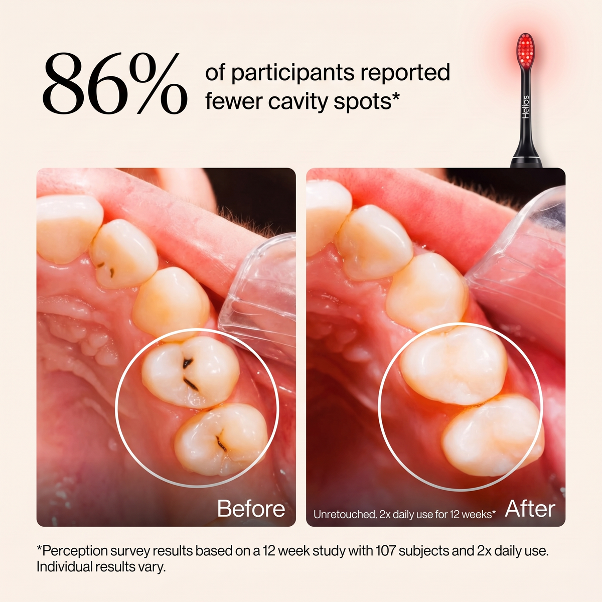 Helios 3-in-1 Therapy Toothbrush