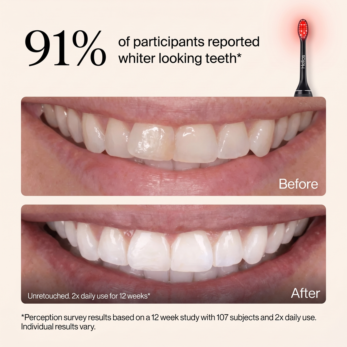 Helios Light Therapy Toothbrush