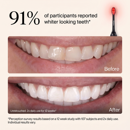 Helios Light Therapy Toothbrush